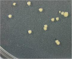 病原菌の培養性状の写真