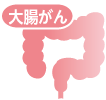 大腸がん