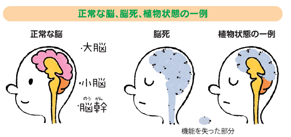 植物 状態 脳死