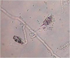 病原菌の分生子の写真