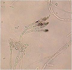 病原菌の分生子柄の写真
