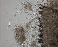 病原菌の子のう及び子のう胞子の写真
