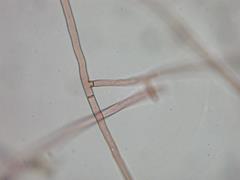 病原菌の菌糸の写真